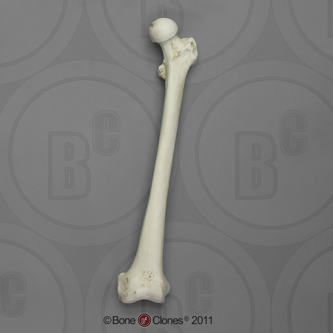 Human Female Asian Femur