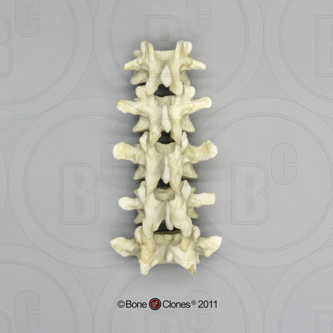 Human Male Asian Robust Lumbar Vertebrae, Set of 5